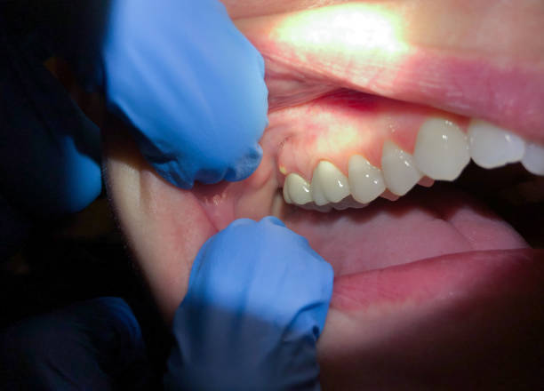 Best Emergency Denture Repair in San Tan Valley, AZ